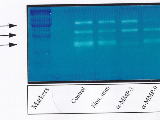 Casein zymogram with molecular weight markers and protease inhibitor lanes